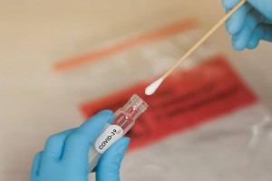 Қазақстанда өткен тәулікте 7778 адамнан коронавирус анықталды