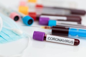 Жапонияда COVID-19 жұқтыру бойынша антирекорд тіркелді
