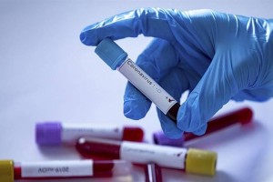 Өткен тәулікте 4826 адамнан коронавирус инфекциясы анықталды